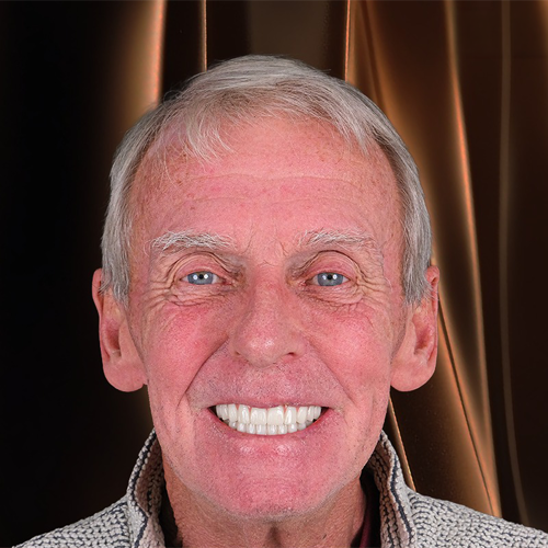 All On 6 dental treatment result
