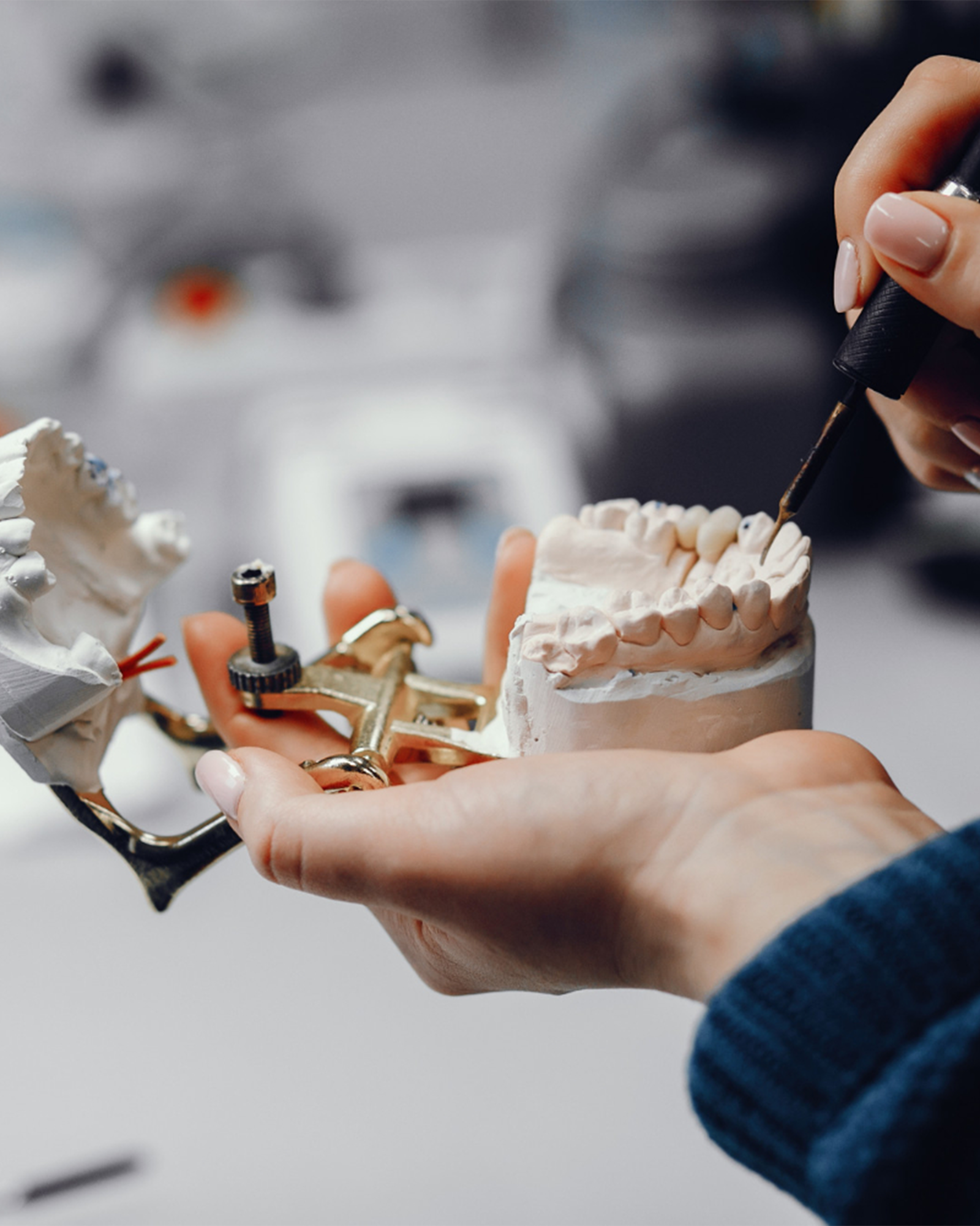 Bone grafting jawbone regeneration procedure at Luxury Dental in Antalya, Turkey - advanced biomaterials and growth factors for dental implant foundation