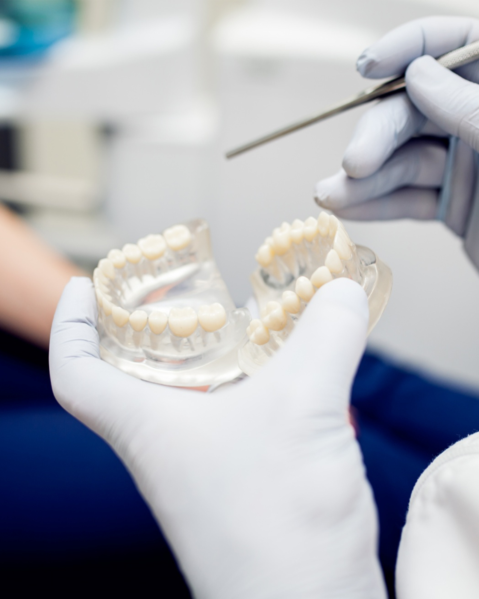 Custom-designed zirconia dental crown at Luxury Dental in Antalya, Turkey - CAD/CAM precision milling with spectrophotometer shade matching