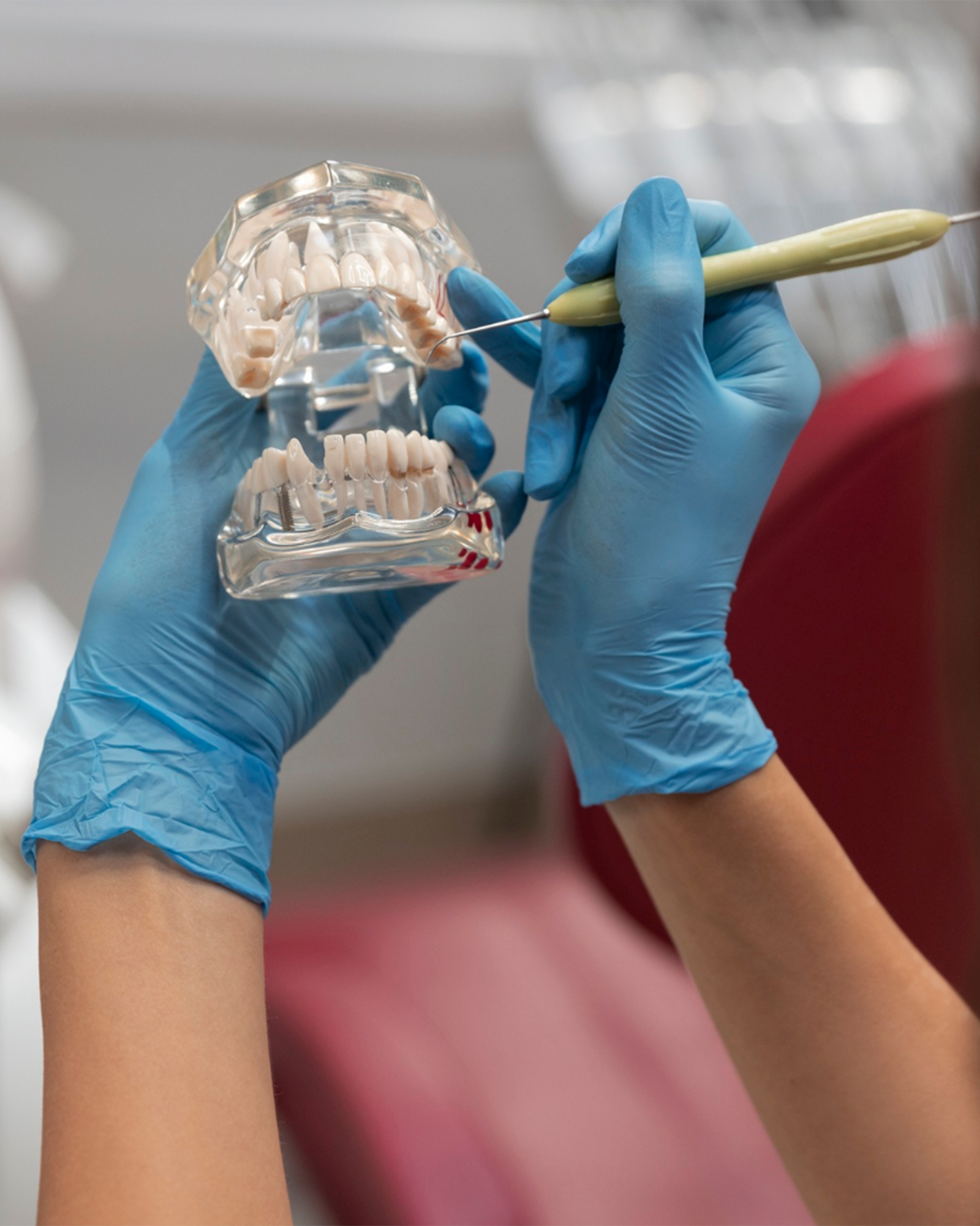 Sinus lift bone augmentation surgery at Luxury Dental in Antalya, Turkey - lateral window and crestal approach techniques for upper jaw implant preparation