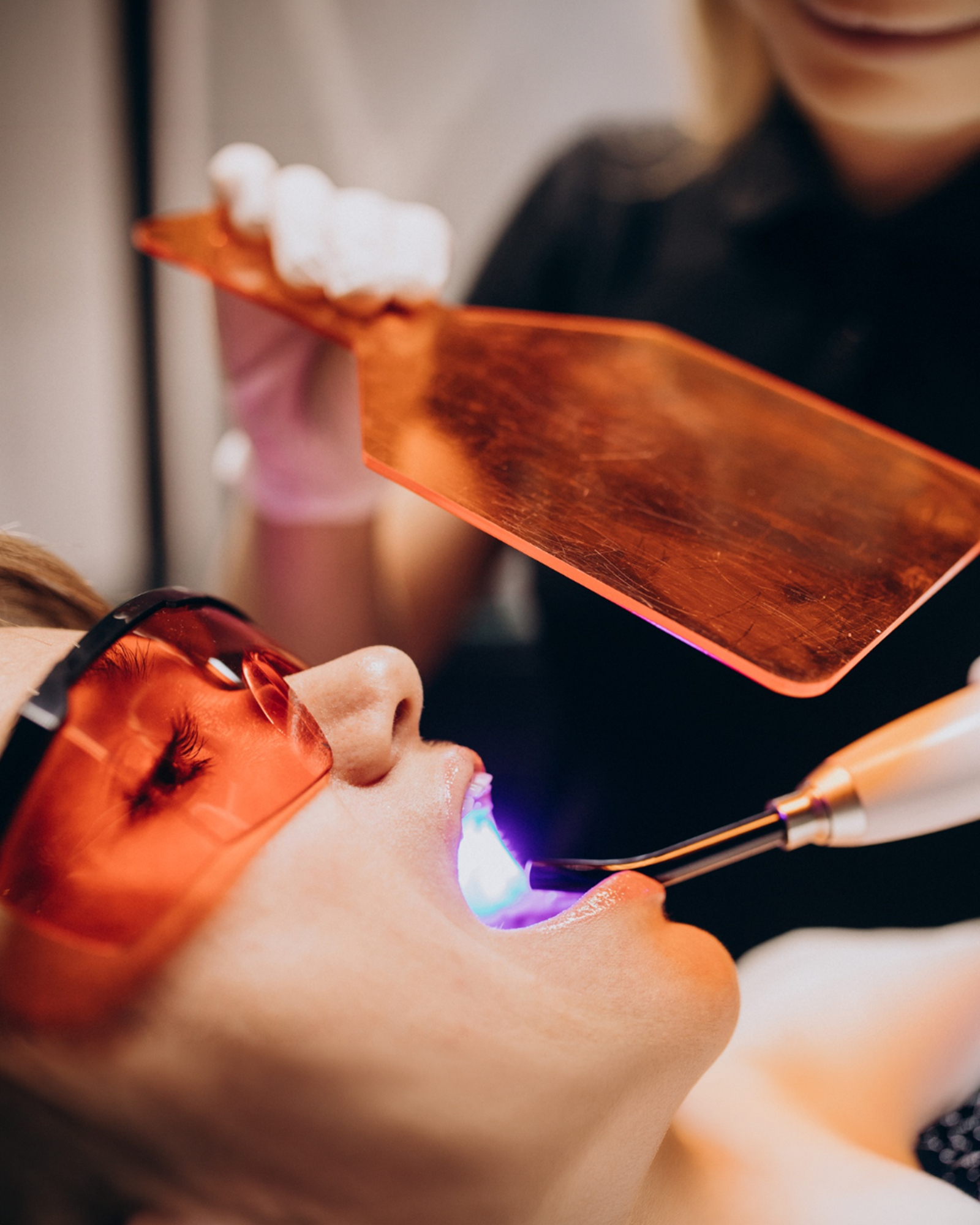 Professional LED laser teeth whitening session at Luxury Dental in Antalya, Turkey - up to 8 shades brighter in one hour with enamel-safe hydrogen peroxide gel