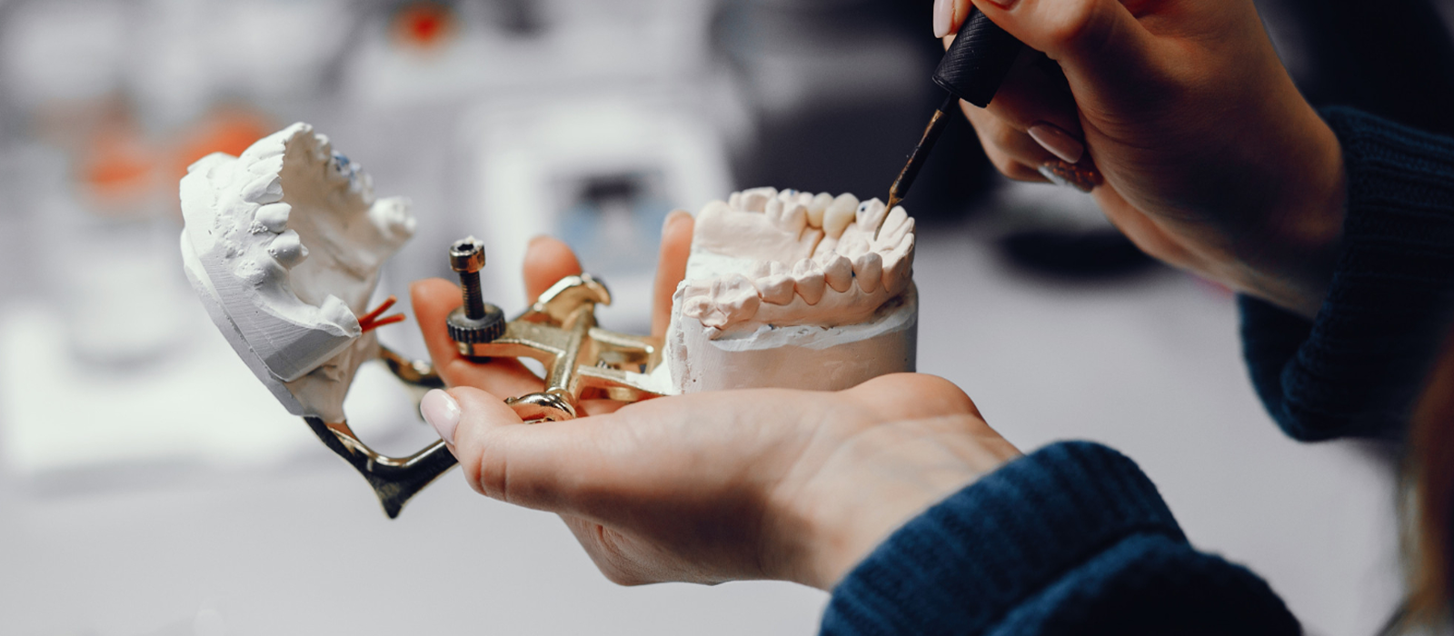 Knochenaufbau-Kieferknochenregeneration in der Luxury Dental Klinik in Antalya, Türkei – fortschrittliche Biomaterialien zur Implantatvorbereitung