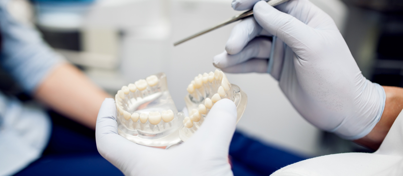 Custom-fitted zirconia dental crown procedure at Luxury Dental clinic in Antalya, Turkey - CAD/CAM precision crown placement